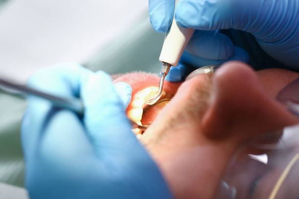 Best Walk-In Emergency Dentist in Prces Lakes, IN