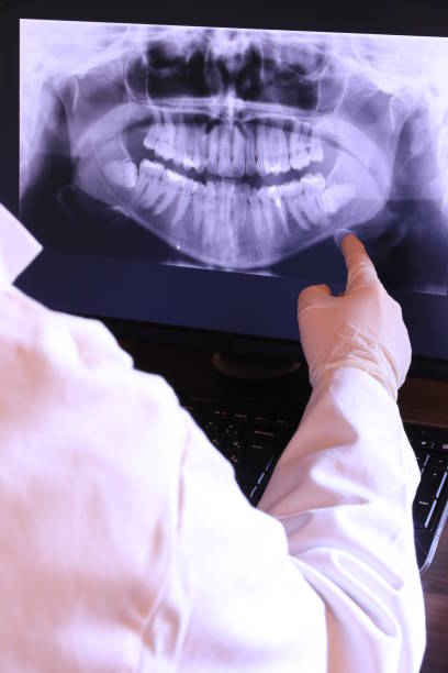 Best Emergency Tooth Extraction in Prces Lakes, IN